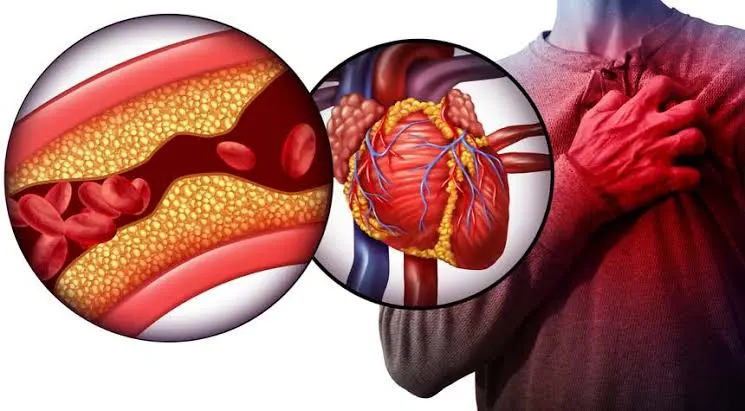 أهم 4 علامات تحذيرية مبكرة قبل الإصابة بنوبة قلبية
